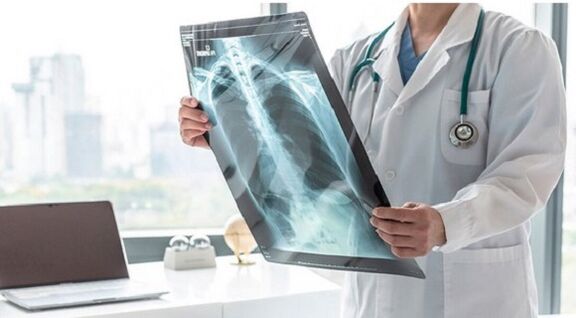 Röntgendiagnostik fir Schmerz ënner der lénkser Schëllerblade