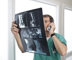 Myelographie fir d'Diagnostik vun Osteochondrose an Intervertebral Hernias