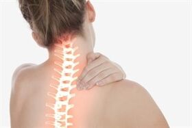 Zervikal Osteochondrose bei enger Fra